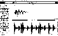 Thumbnail for version as of 22:02, 27 February 2016